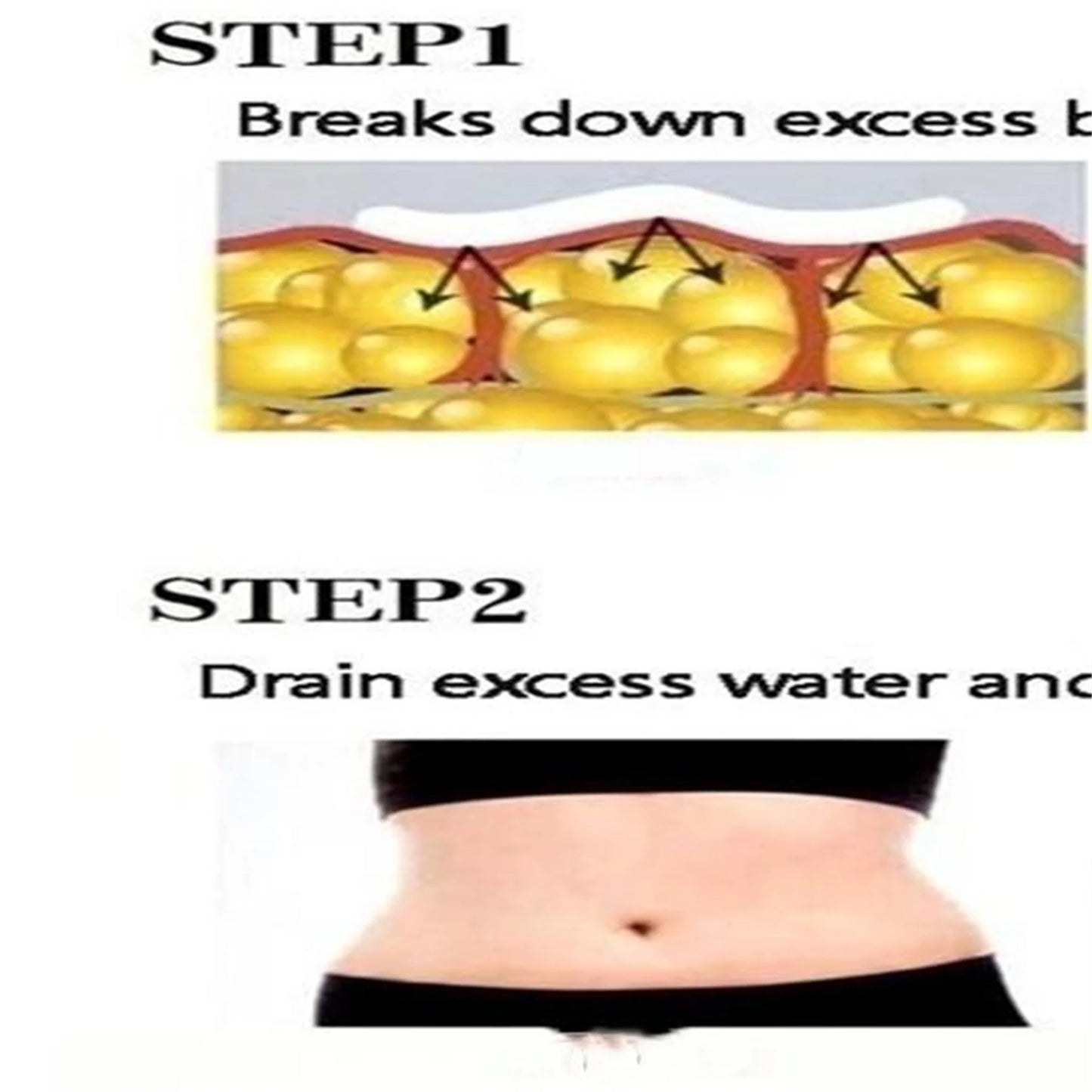 5ML/15ML/30ML/50ML Fat burning spray eliminates Cellulitis Skin elasticity decomposes fat Massage improves skin burner Slimming